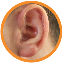 Caulear Protection Ear Shields